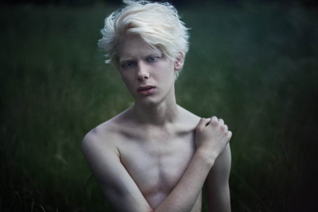 Beautiful Albino Human My XXX Hot Girl