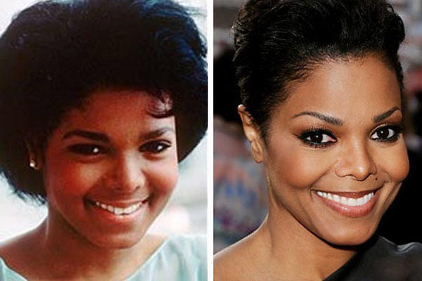 plastic surgery Janet Jackson