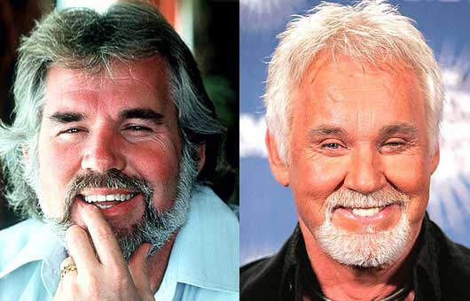 plastic surgery Kenny Rogers