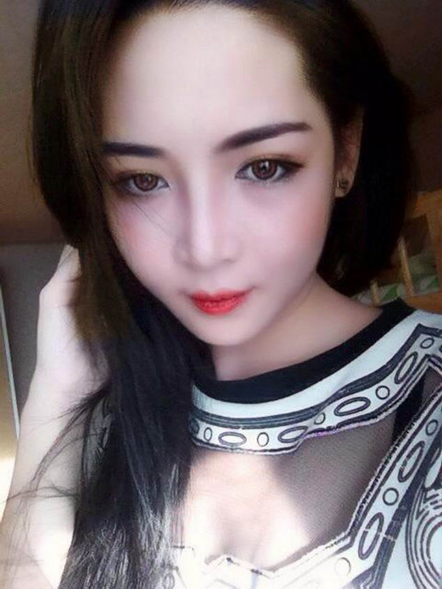 plastic-surgery-vietnam-girl-03