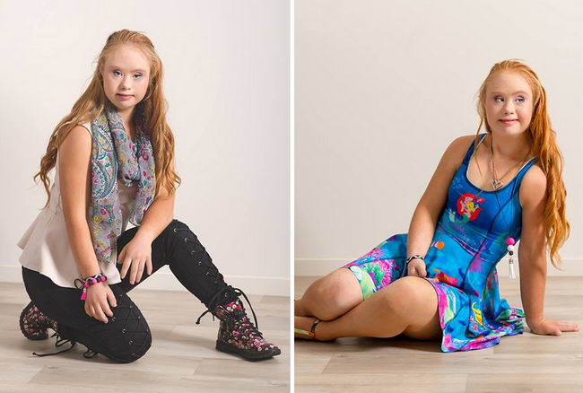 down-syndrome-model-09