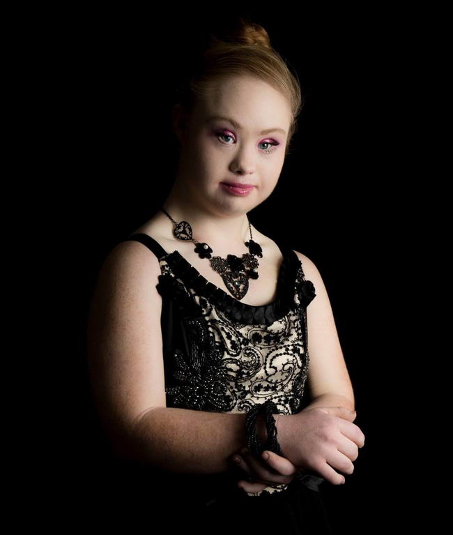 down-syndrome-model-10