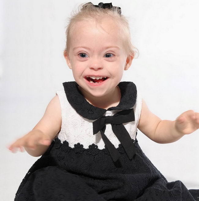 down-syndrome-model-06