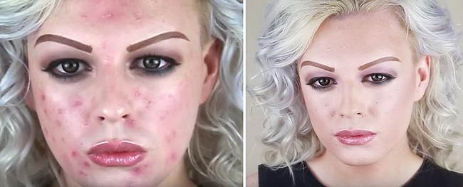 acne-makeup-01