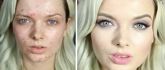 acne-makeup-06