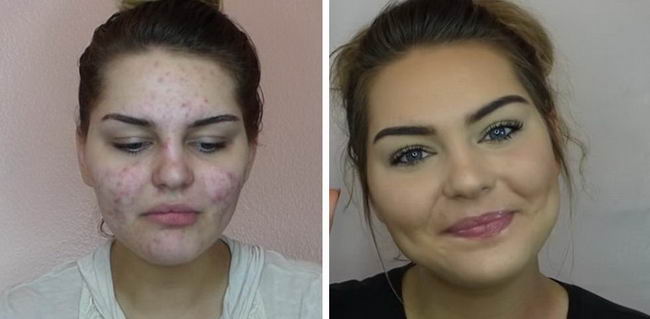 acne-makeup-11