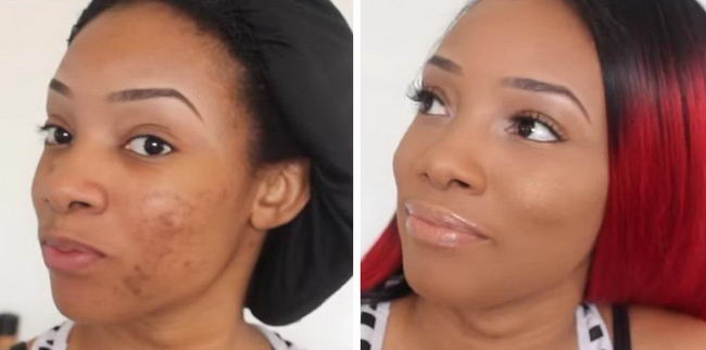 acne-makeup-12