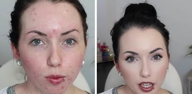 acne-makeup-16
