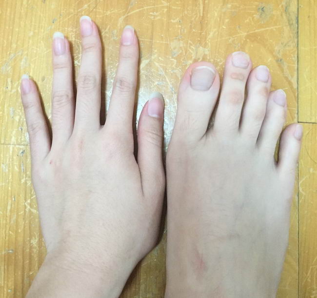 finger-foot-long-04