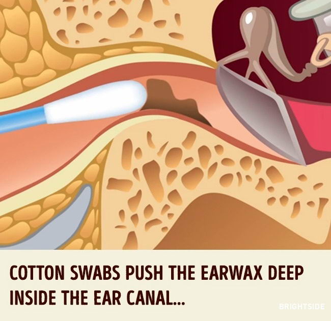 cotton-swabs-ear-02