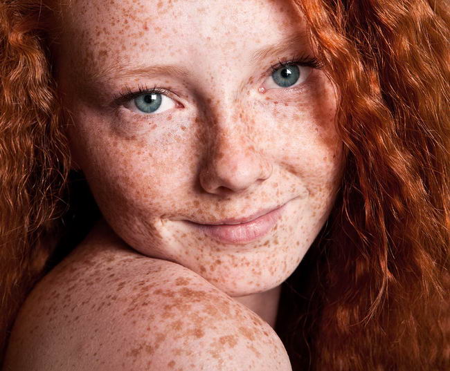 Cheerful freckled girl